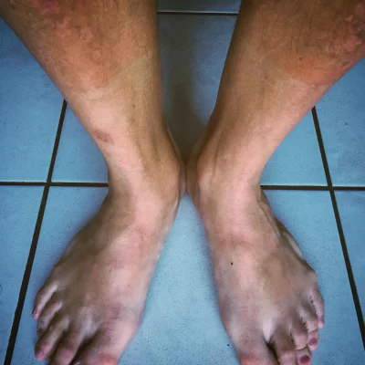 ⚽️🌞🍺 #bronzage de chaussettes